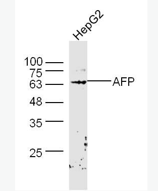Anti-AFP antibody-甲胎蛋白AFP抗体,AFP