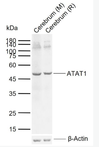 Anti-ATAT1 antibody-α微管蛋白乙酰转移酶1抗体,ATAT1