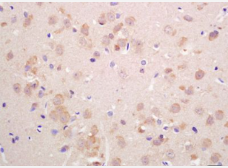 Anti-VGLUT2 antibody-囊泡谷氨酸轉(zhuǎn)運(yùn)蛋白2抗體,VGLUT2