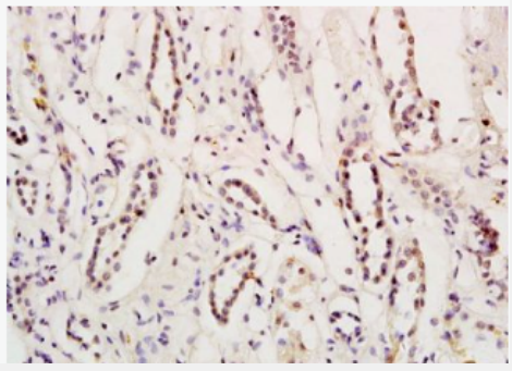 Anti-Myocardin antibody-促血管平滑肌細胞分化因子抗體,Myocardin