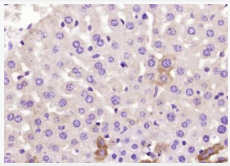 Anti-C1QC antibody-补体C1qγ链多肽抗体,C1QC