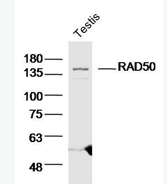 Anti-RAD50 antibody-DNA修復(fù)蛋白Rad50抗體,RAD50