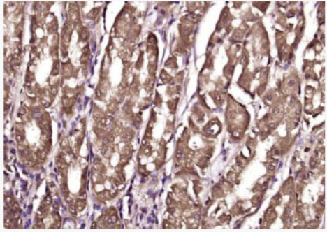 Anti-Cytohesin 2  antibody-胞粘蛋白2抗体,Cytohesin 2