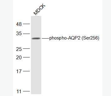 Anti-phospho-AQP2 (Ser256) antibody-磷酸化水通道蛋白2抗体,phospho-AQP2 (Ser256)