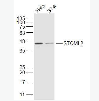 Anti-STOML2 antibody-溴化丙胺太林相关蛋白2抗体,STOML2
