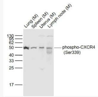 Anti-phospho-CXCR4 (Ser339) antibody-磷酸化細胞表面趨化因子受體4抗體,phospho-CXCR4 (Ser339)