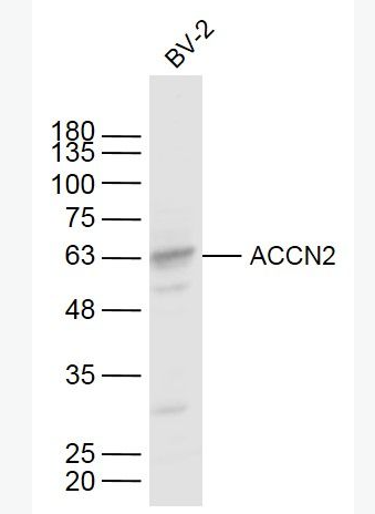 Anti-ACCN2 antibody-脑钠通道蛋白2抗体,ACCN2