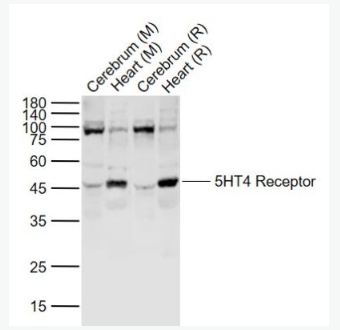 Anti-5HT4 Receptor antibody-5-羟色胺受体4抗体,5HT4 Receptor