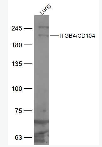 Anti-ITGB4/CD104 antibody-整合素β4抗体,ITGB4/CD104