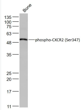 Anti-phospho-CXCR2 (Ser347) antibody-磷酸化细胞表面趋化因子受体2抗体,phospho-CXCR2 (Ser347)