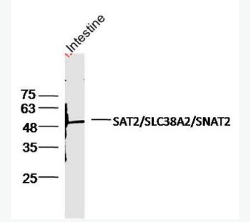 Anti-SLC38A2 antibody-氨基酸转运蛋白2抗体,SLC38A2