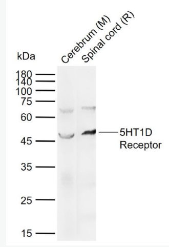 Anti-5HT1D Receptor  antibody-5-羟色胺受体1D抗体,5HT1D Receptor