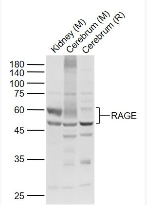 Anti-RAGE antibody-晚期糖基化终末产物特异性受体抗体,RAGE