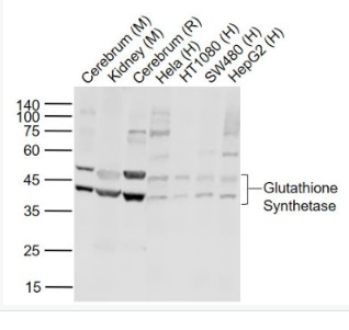 Anti-Glutathione Synthetase antibody-谷胱甘肽合成酶抗体,Glutathione Synthetase