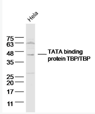 Anti-TBP antibody-TATA结合蛋白抗体,TBP