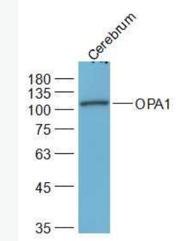 Anti-OPA1 antibody-視神經(jīng)萎縮相關(guān)蛋白1抗體,OPA1