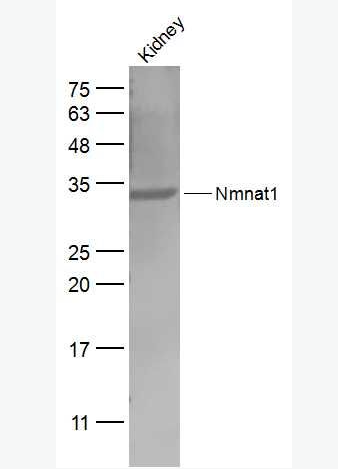 Anti-Nmnat1 antibody-烟酰胺核苷酸腺苷转移酶1抗体,Nmnat1