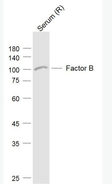 Anti-Factor B antibody-补体因子B抗体,Factor B