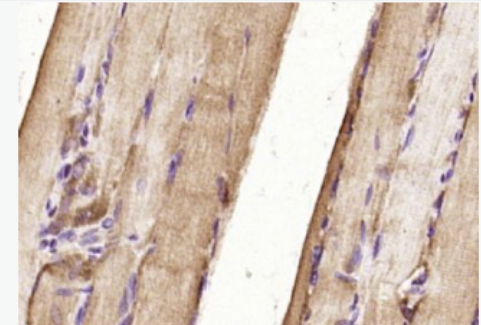 Anti-UCHL3 antibody-泛素硫酯酶L3抗體,UCHL3