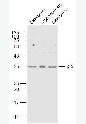 Anti-CDK5R1/p35 antibody-细胞周期蛋白依赖性激酶5激活因子1抗体,CDK5R1/p35