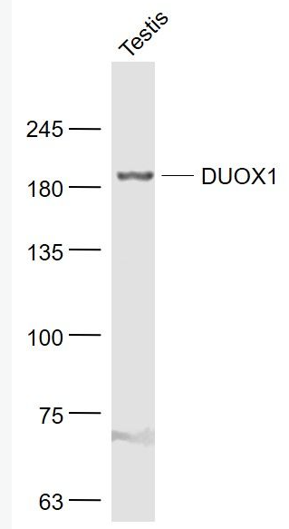 Anti-DUOX1 antibody-雙氧化酶1/甲狀腺氧化酶1抗體,DUOX1