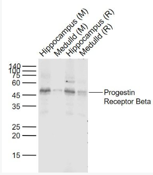 Anti-Progestin Receptor Beta antibody-孕激素受体β（MPRβ）抗体,Progestin Receptor Beta