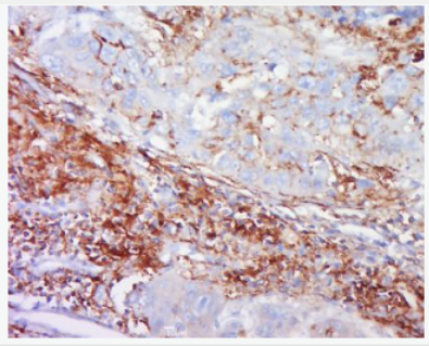 Anti-FUNDC1 antibody-X三體綜合癥相關(guān)蛋白FUNDC1抗體,FUNDC1