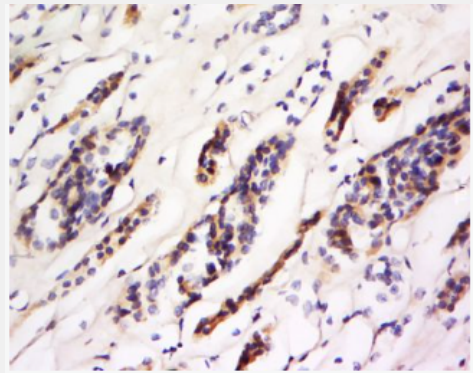 Anti-CD93 antibody-CD93抗體,CD93