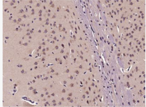 Anti-Semaphorin 3D antibody-跨膜蛋白SEMA3D抗體,Semaphorin 3D