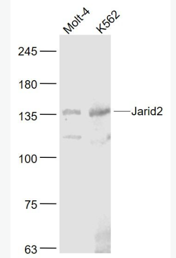 Anti-Jarid2 antibody-組蛋白去甲基化酶JARID2抗體,Jarid2