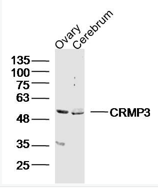 Anti-CRMP3 antibody-二氢嘧啶酶相关蛋白3抗体,CRMP3