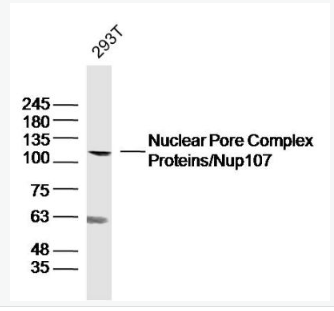 Anti-NUP107 antibody-核孔復(fù)合體蛋白抗體,NUP107