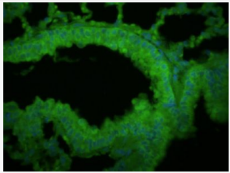 Anti-SFTPC antibody-肺表面活性蛋白C抗体,SFTPC