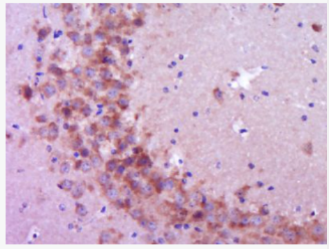 Anti-Cryptochrome 1 antibody-隱花色素蛋白1抗體,Cryptochrome 1