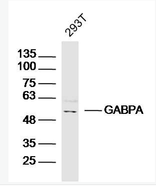 Anti-GABPA antibody-GA结合蛋白转录因子α/GABP-α抗体,GABPA