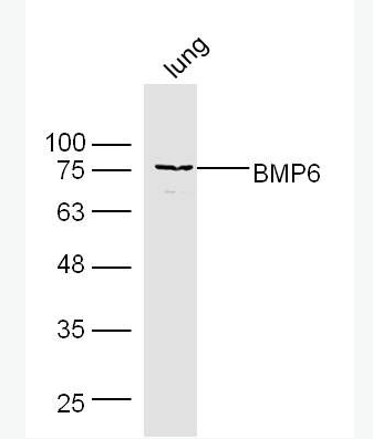 Anti-BMP6 antibody-骨形態(tài)發(fā)生蛋白6抗體,BMP6