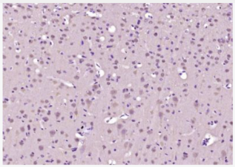 Anti-SHANK3 antibody-富含脯氨酸突触相关蛋白SHANK3抗体,SHANK3