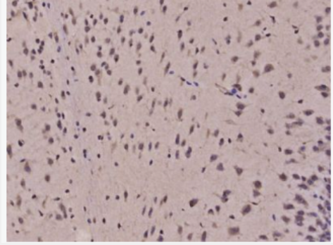 Anti-PCSK2/Proprotein Convertase 2 antibody-神经内分泌转化酶2抗体,PCSK2/Proprotein Convertase 2