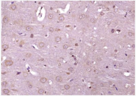 Anti-phospho-IRE1a (Ser 726) antibody-磷酸化内质网核信号转导蛋白a1抗体,phospho-IRE1a (Ser 726)