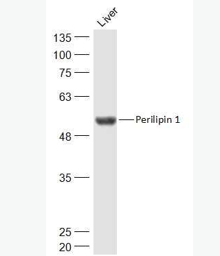 Anti-Perilipin 1 antibody-脂滴包被蛋白Perilipin-A抗体,Perilipin 1