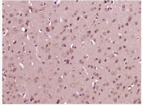 Anti-IL23 P19 antibody-白細(xì)胞介素23P19抗體,IL23 P19