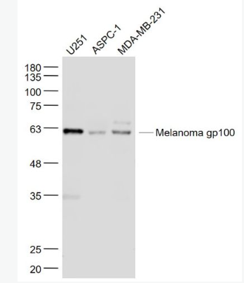 Anti-Melanoma gp100 antibody-黑色素瘤相关抗原gp100抗体,Melanoma gp100