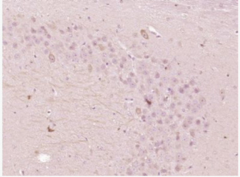 Anti-OSBPL5 antibody-氧固醇结合蛋白样5抗体,OSBPL5