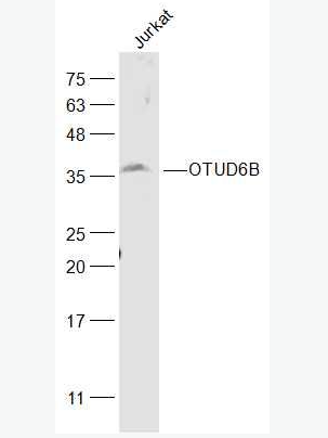 Anti-OTUD6B antibody-OTUD6B蛋白抗體,OTUD6B