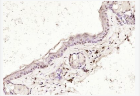 Anti-hnRNP A1 antibody-核糖核蛋白顆粒A1蛋白抗體,hnRNP A1