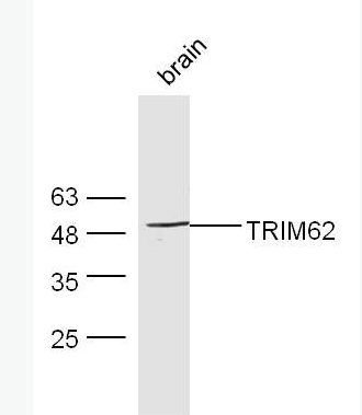 Anti-TRIM62 antibody-TRIM62蛋白抗体,TRIM62