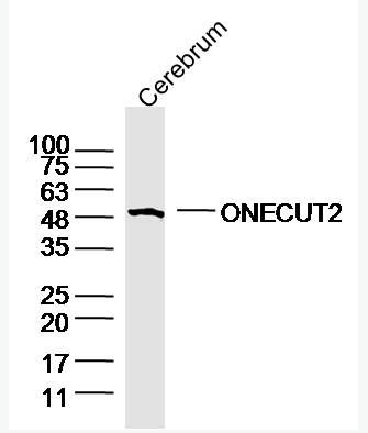 Anti-ONECUT2 antibody-轉(zhuǎn)錄因子ONECUT2抗體,ONECUT2