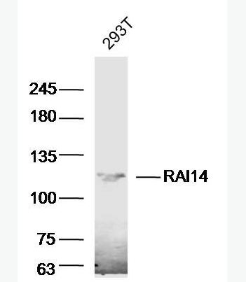 Anti-RAI14 antibody-维甲酸诱导蛋白14抗体,RAI14