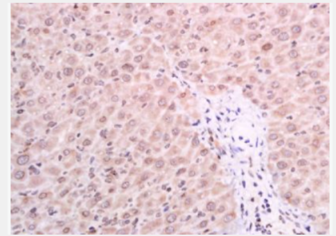 Anti-GSDMA antibody-gasdermin蛋白抗体,GSDMA