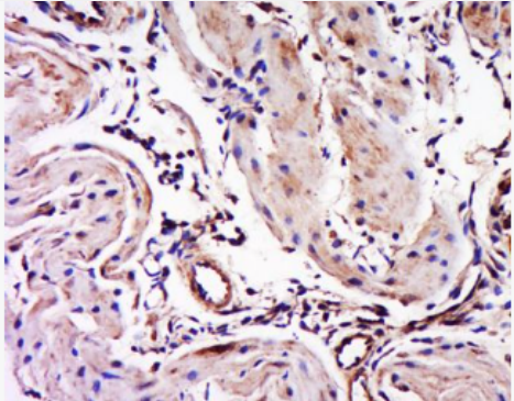 Anti-Myosin-3 antibody-肌球蛋白3抗體,Myosin-3